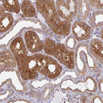 Immunohistochemistry-Paraffin: SNX8 Antibody [NBP2-31672]