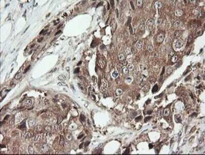 Immunohistochemistry: SNX8 Antibody (OTI1A1) - Azide and BSA Free [NBP2-74265]