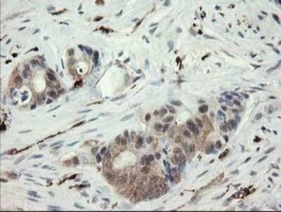 Immunohistochemistry: SNX8 Antibody (OTI1A1) - Azide and BSA Free [NBP2-74265]