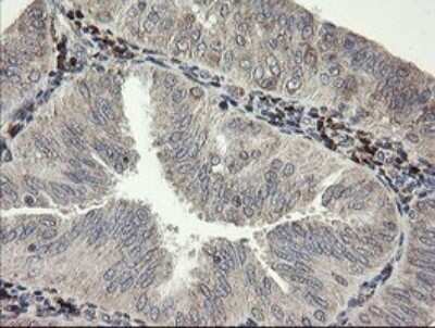 Immunohistochemistry: SNX8 Antibody (OTI1A1) - Azide and BSA Free [NBP2-74265]