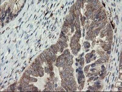 Immunohistochemistry: SNX8 Antibody (OTI1A1) - Azide and BSA Free [NBP2-74265]