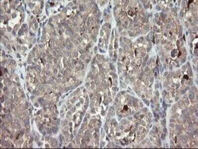 Immunohistochemistry: SNX8 Antibody (OTI1A1) - Azide and BSA Free [NBP2-74265]