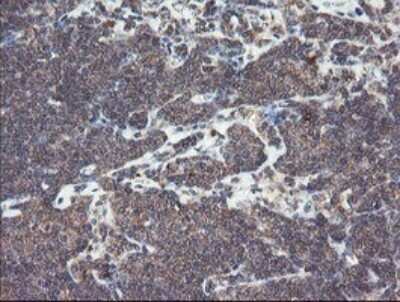 Immunohistochemistry: SNX8 Antibody (OTI1A1) - Azide and BSA Free [NBP2-74265]