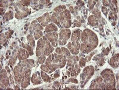 Immunohistochemistry: SNX8 Antibody (OTI1A1) - Azide and BSA Free [NBP2-74265]