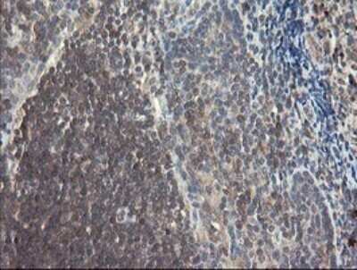 Immunohistochemistry: SNX8 Antibody (OTI1A1) - Azide and BSA Free [NBP2-74265]