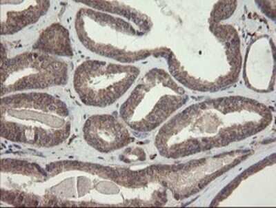 Immunohistochemistry: SNX8 Antibody (OTI1A1) [NBP2-45896]
