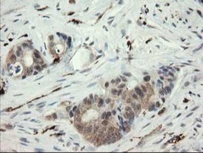 Immunohistochemistry: SNX8 Antibody (OTI1A1) [NBP2-45896]
