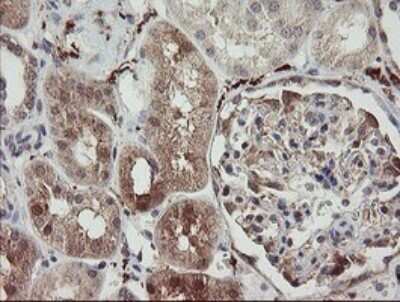 Immunohistochemistry: SNX8 Antibody (OTI1A1) [NBP2-45896]