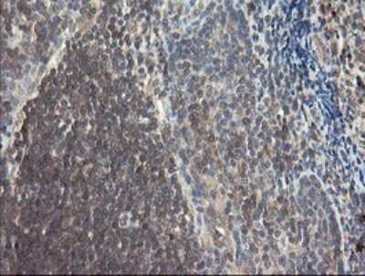 Immunohistochemistry: SNX8 Antibody (OTI1A1) [NBP2-45896]