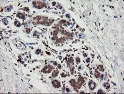 Immunohistochemistry: SNX8 Antibody (OTI1A1) [NBP2-45896]