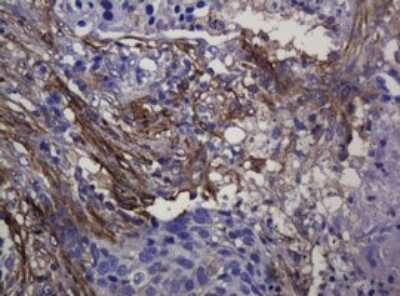 Immunohistochemistry: SOAT 2 Antibody (OTI2D3) [NBP2-45981]