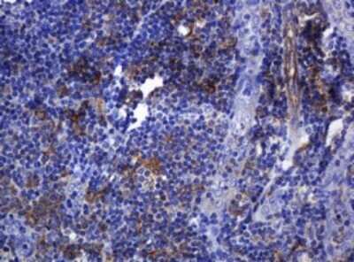 Immunohistochemistry: SOAT 2 Antibody (OTI2D3) - Azide and BSA Free [NBP2-74271]