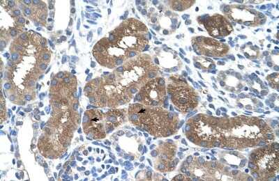 Immunohistochemistry: SOCS-1 Antibody [NBP1-58943]