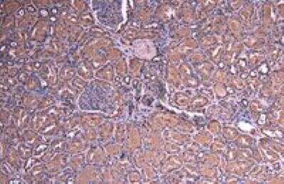 Immunohistochemistry-Paraffin: SOCS-1 Antibody [NB100-781]