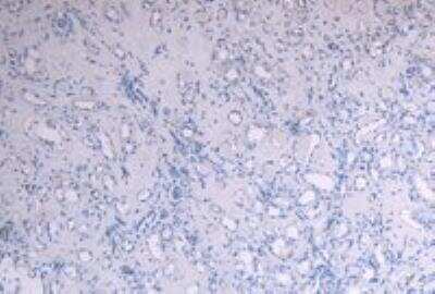 Immunohistochemistry-Paraffin: SOCS-1 Antibody [NB100-781]