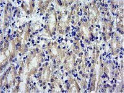 Immunohistochemistry-Paraffin: SOCS-1 Antibody [NB100-781]