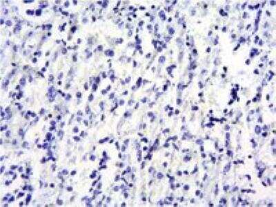 Immunohistochemistry-Paraffin: SOCS-1 Antibody [NB100-781]
