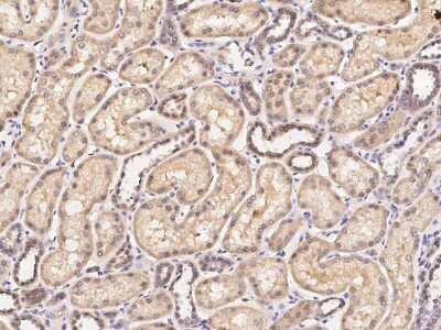 Immunohistochemistry-Paraffin: SOCS-1 Antibody [NBP2-98892]