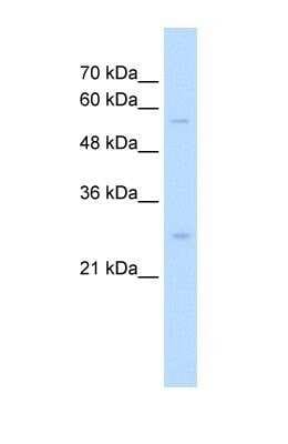 Western Blot: SOCS-1 Antibody [NBP1-58943]