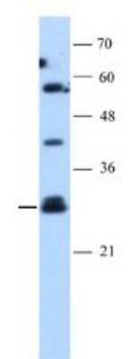 Western Blot: SOCS-1 Antibody [NBP1-58943]
