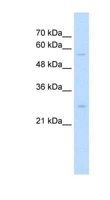 Western Blot: SOCS-1 Antibody [NBP1-58943]