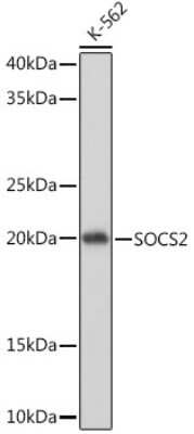 Western Blot: SOCS-2 Antibody (6D3F6) [NBP3-16781]