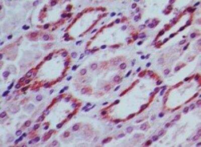 Immunohistochemistry-Paraffin: SOCS-3 Antibody [NBP2-27210]