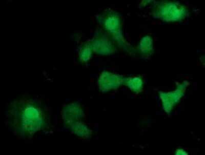 Immunocytochemistry/ Immunofluorescence: SOCS-3 Antibody (OTI3D3) - Azide and BSA Free [NBP2-74276]