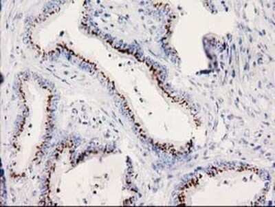 Immunohistochemistry: SOCS-3 Antibody (OTI3D3) - Azide and BSA Free [NBP2-74276]