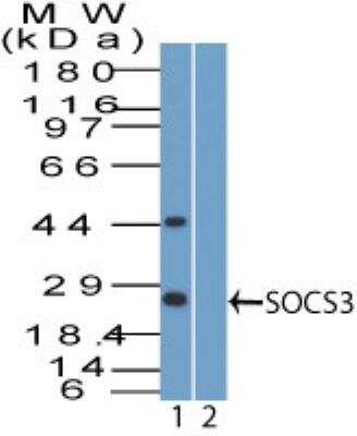 Western Blot: SOCS-3 Antibody [NBP2-27210]