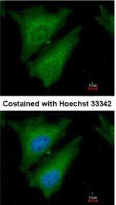 Immunocytochemistry/ Immunofluorescence: SOCS-4 Antibody [NBP1-31007]