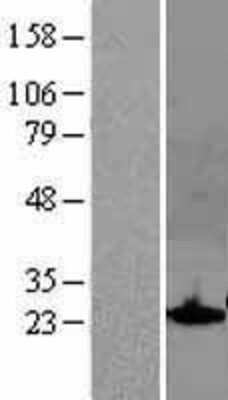 Western Blot: SOCS-1 Overexpression Lysate [NBL1-16325]
