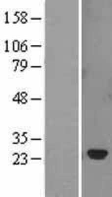 Western Blot: SOCS-2 Overexpression Lysate [NBL1-16326]