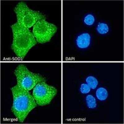 Immunocytochemistry/ Immunofluorescence: SOD1/Cu-Zn SOD Antibody [NB100-60944]