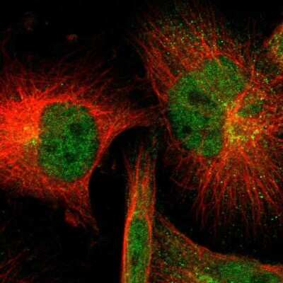 Immunocytochemistry/ Immunofluorescence: SOD1/Cu-Zn SOD Antibody [NBP1-90186]