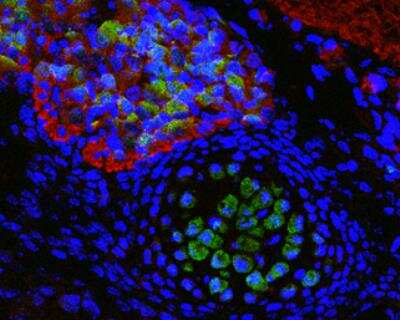 Immunohistochemistry-Frozen: SOD1/Cu-Zn SOD Antibody [NBP2-20534]