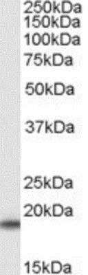 Western Blot: SOD1/Cu-Zn SOD Antibody [NB100-60944]