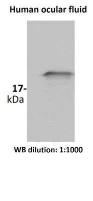 Western Blot: SOD1/Cu-Zn SOD Antibody [NBP2-24915]