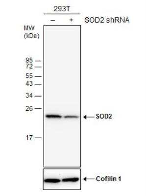 Western Blot: SOD2/Mn-SOD Antibody (582) [NBP2-43795]