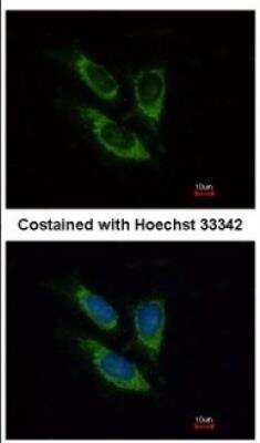 Immunocytochemistry/ Immunofluorescence: SOD2/Mn-SOD Antibody [NBP2-20535]