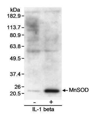 Western Blot: SOD2/Mn-SOD Antibody [NB200-165]