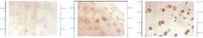 Immunohistochemistry: SOD3/EC-SOD Antibody (4GG11G6) [NBP1-22417]