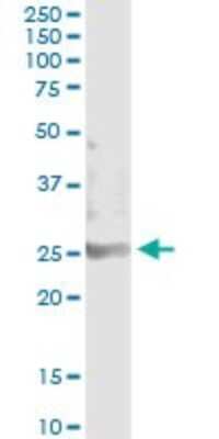 Immunoprecipitation: SOHLH2 Antibody (1E1) [H00054937-M04]