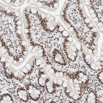 Immunohistochemistry-Paraffin: SON Antibody [NBP1-88706]