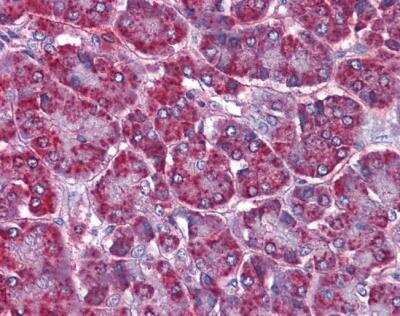 Immunohistochemistry: SORBS1 Antibody [NBP1-06079]