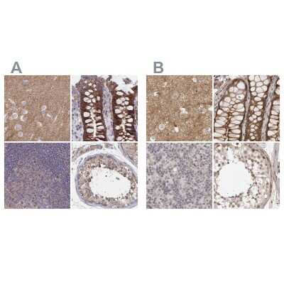 Immunohistochemistry-Paraffin: SORBS1 Antibody [NBP2-33383]