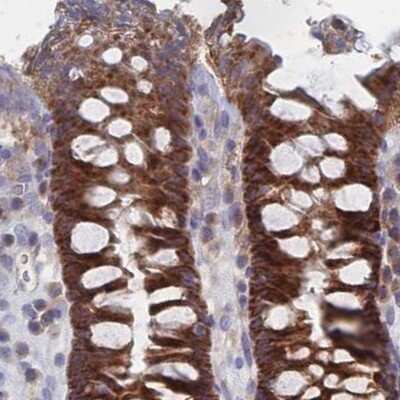 Immunohistochemistry-Paraffin: SORBS1 Antibody [NBP2-33383]