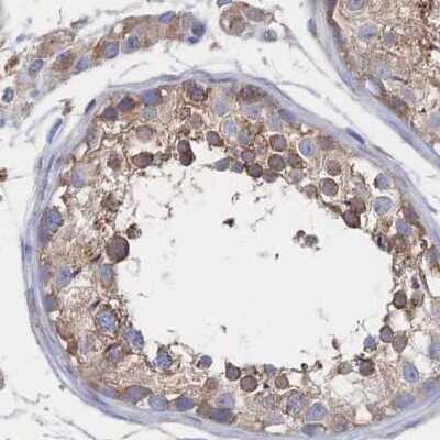 Immunohistochemistry-Paraffin: SORBS1 Antibody [NBP2-33383]