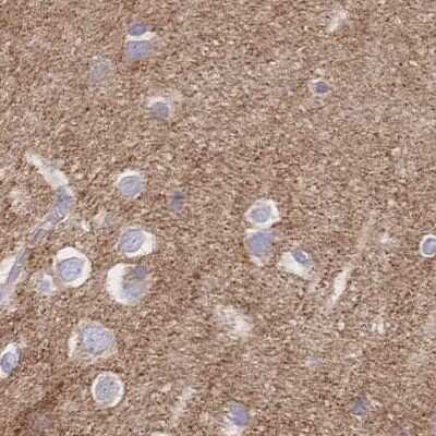 Immunohistochemistry-Paraffin: SORBS1 Antibody [NBP2-33383]