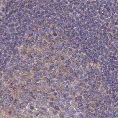 Immunohistochemistry-Paraffin: SORBS1 Antibody [NBP2-33383]